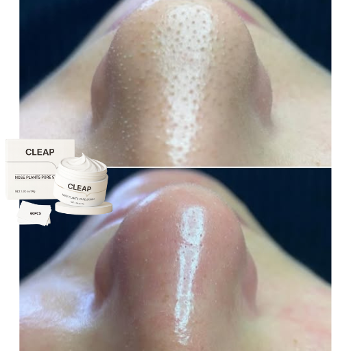 Antes y despu&eacute;s Cleap